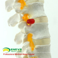 SPINE01 (12372) Medical Science Nature Classic Flexible Spine Model without Pelvis , Spine/Vertebrae Models > Life-Size Spine